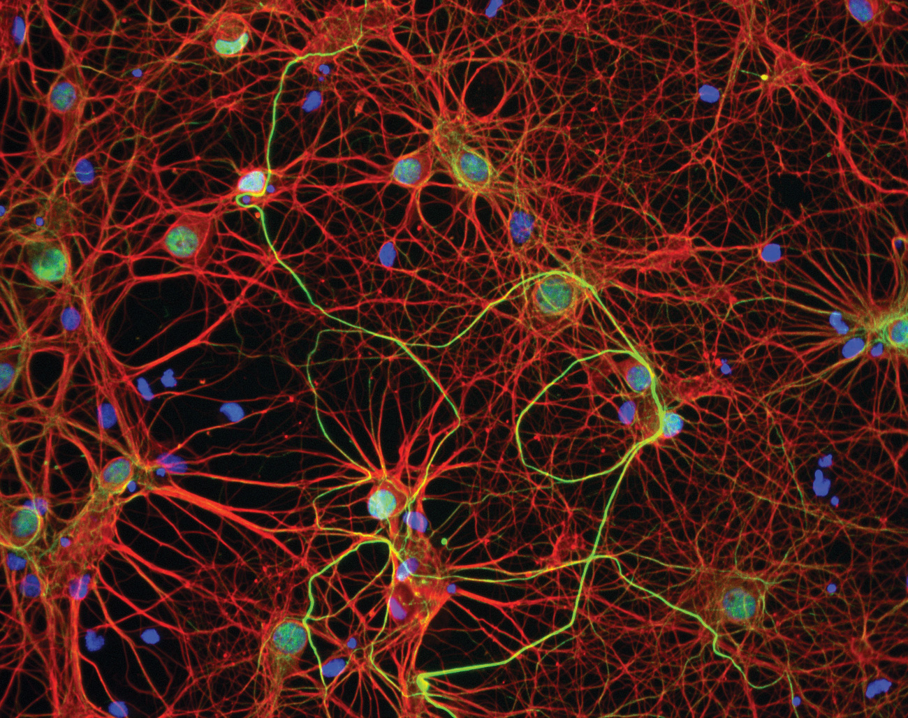 neuron brain