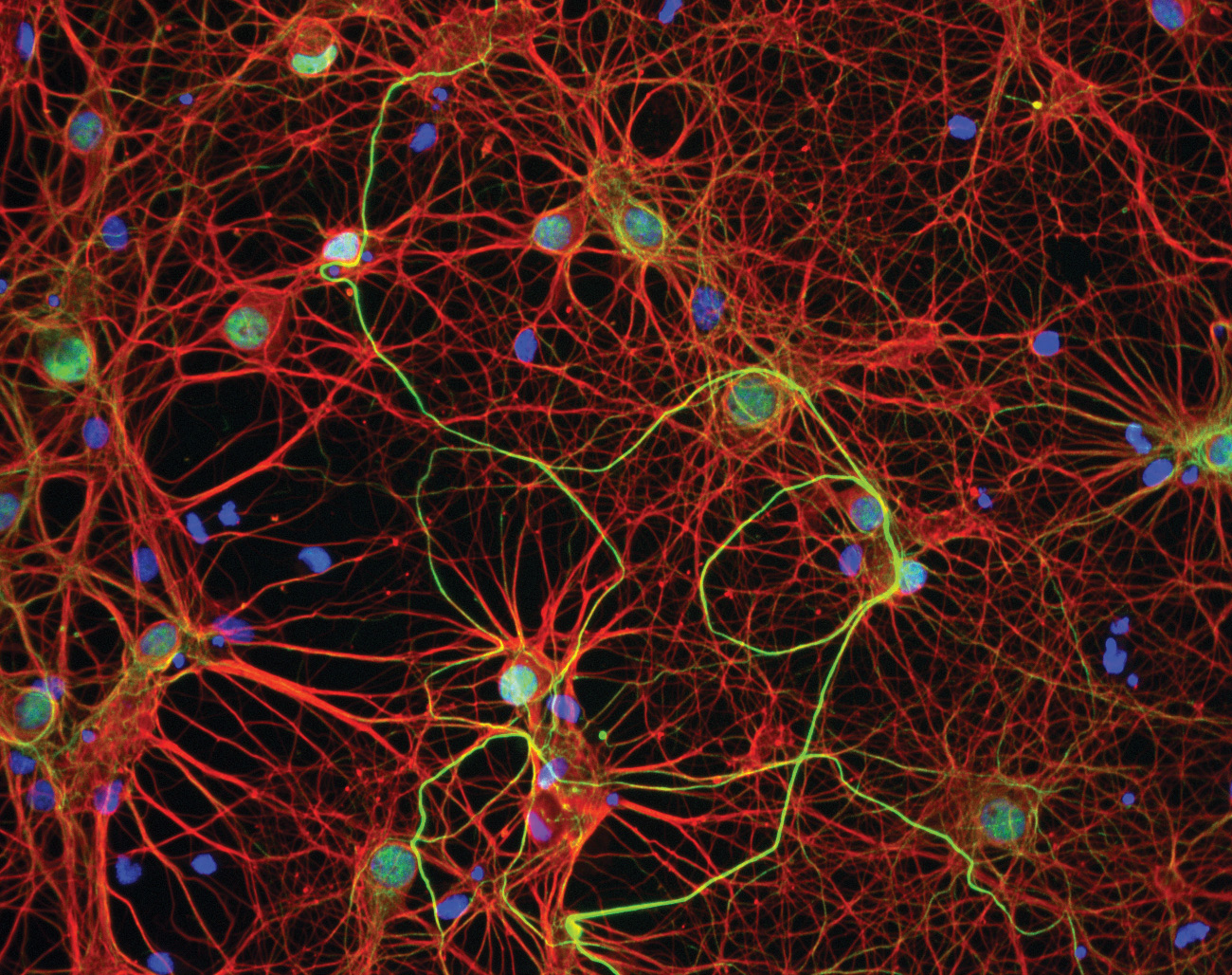 the-neuron-is-the-building-block-of-the-nervous-system